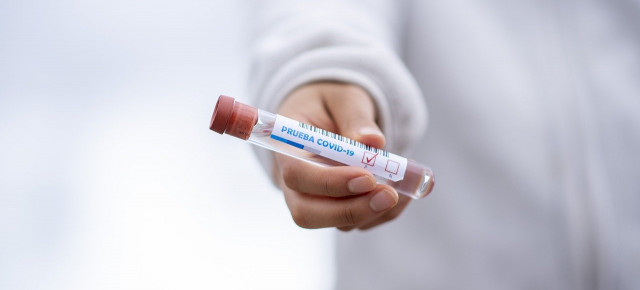Proponemos un Plan de Choque sobre test diagnósticos para combatir al coronavirus de forma eficiente